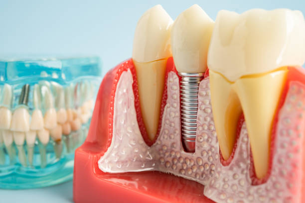 Our Range of Dental Services in Baytown, TX